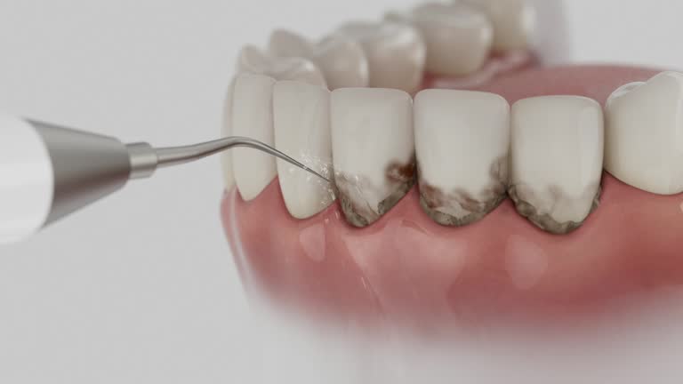 Reliable Dental Implants contractor in Decatur, TX by Smile Center Dentistry